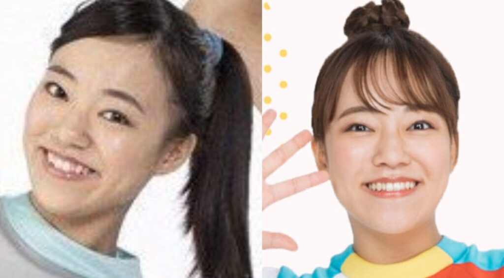 あづきお姉さんが可愛くなった理由3選!歯列矯正して垢抜けた?